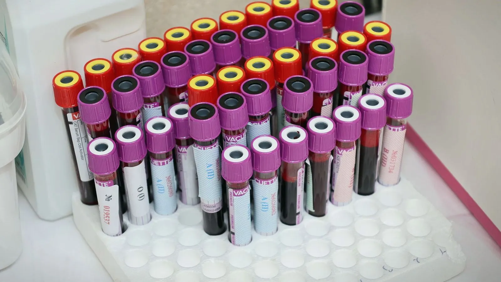 Blood sample vials in a laboratory rack